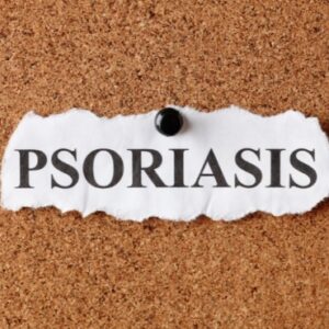 A pin board with a torn piece of paper showing the word Psoriasis pinned to it